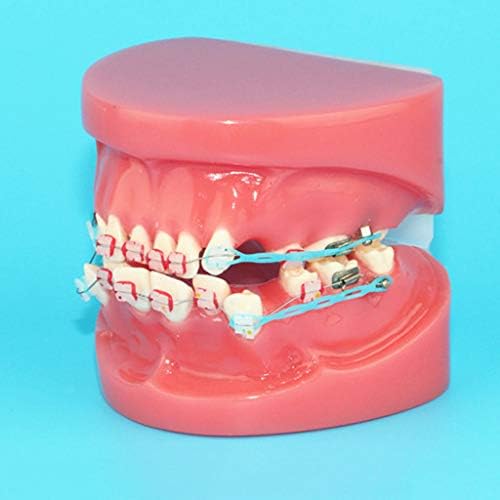 K99 Ortodontik Modeli Diş Ağız Tam Seramik Diş Düzeltme Modeli Tedavi Çalışma Modeli Öğretim Ağız Sağlığı Sunum
